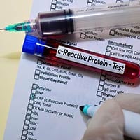 C-Reactive Protein Test: What Is It And What To Expect?