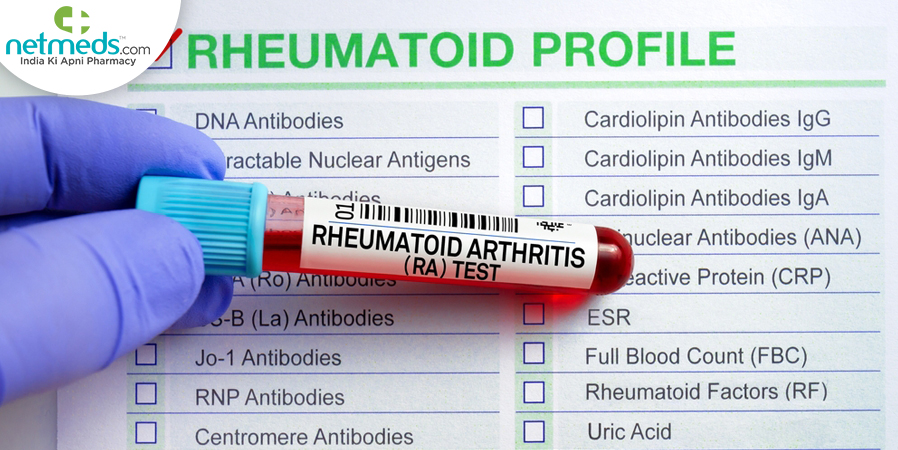 Rheumatoid Arthritis