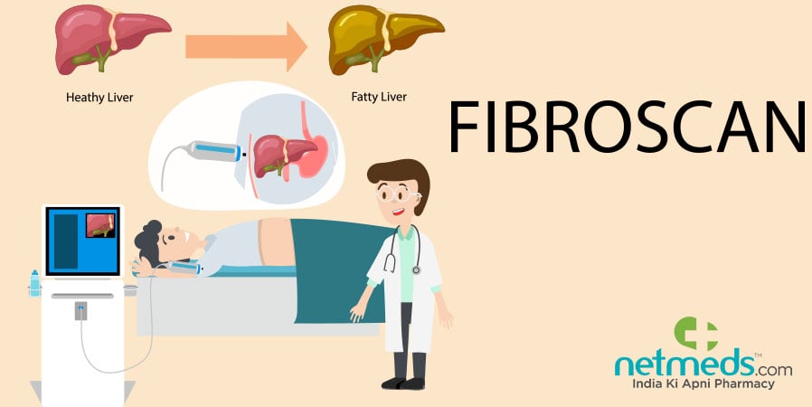 Fibroscan