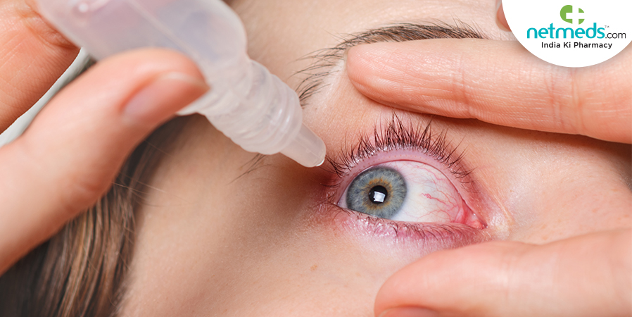Eye infection