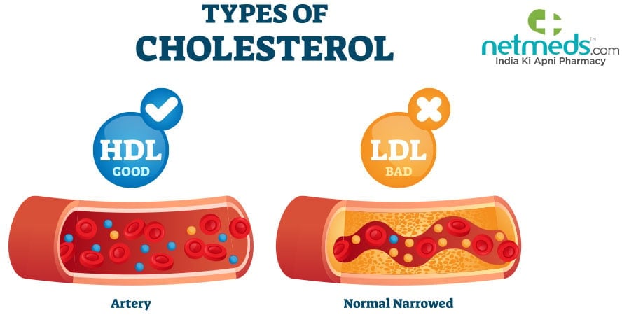 Types of cholesterol