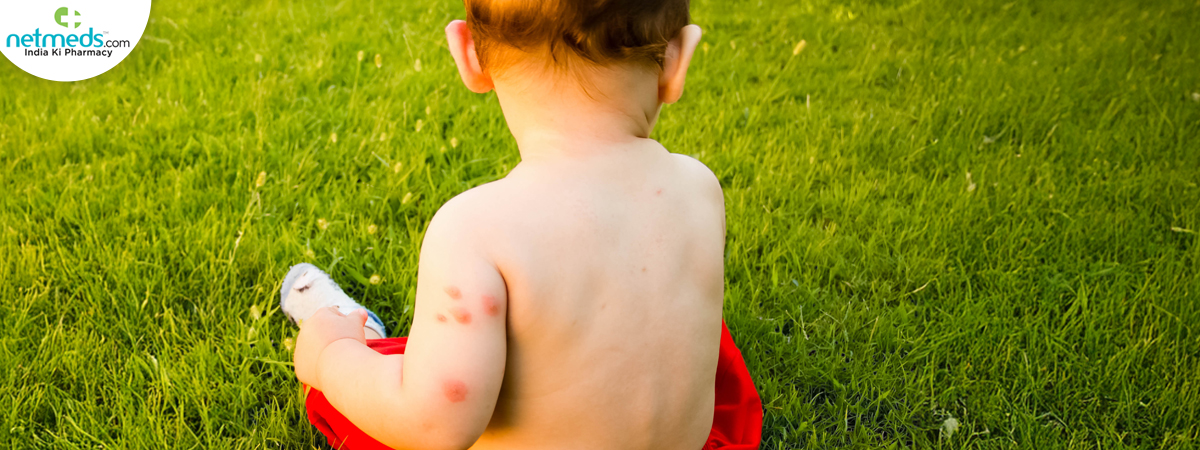 Bug-bite-remedies_1200x450