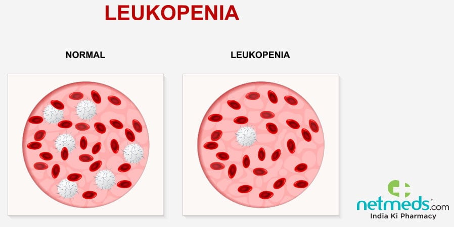 Leukopenia