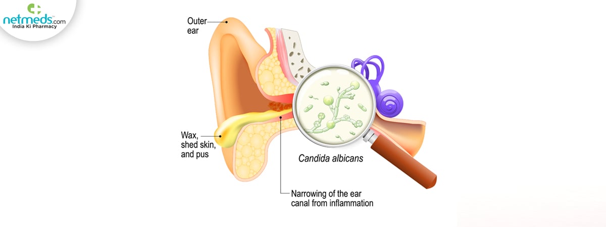 otitis-swimmers-ear_1200x450