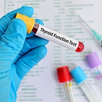 Thyroid Function Tests: Why It Is Done and What To Expect