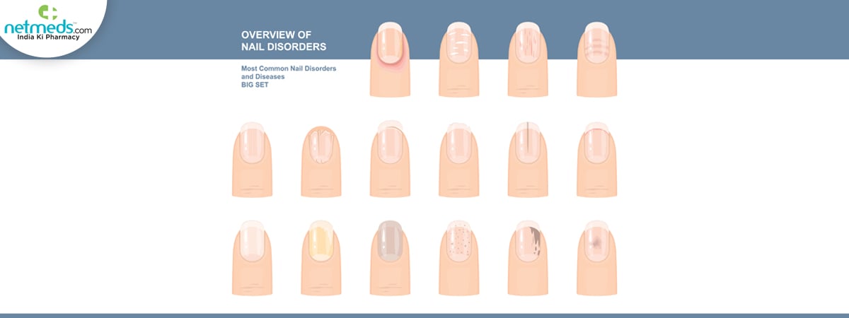 nail-disorders-diseases_1200x450