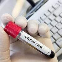 A/G Ratio Test: Purpose, Procedure And Results