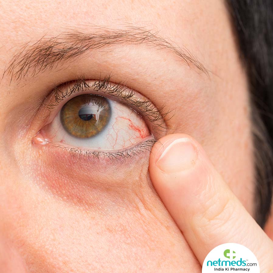  Tested For Retinal Detachment