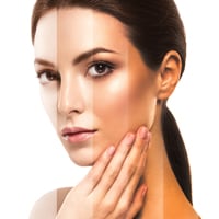 Got Skin Tan? Discover 5 Quick And Natural Ways To Remove Pigmentation At Home
