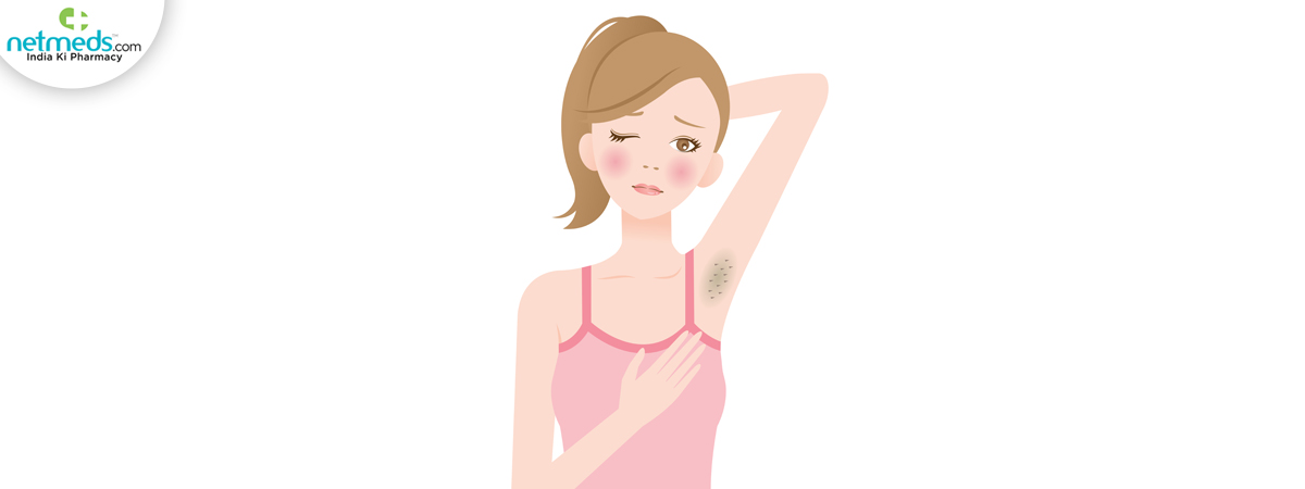 Armpit-rash_1200x450