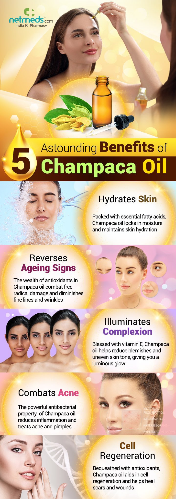 Champaca