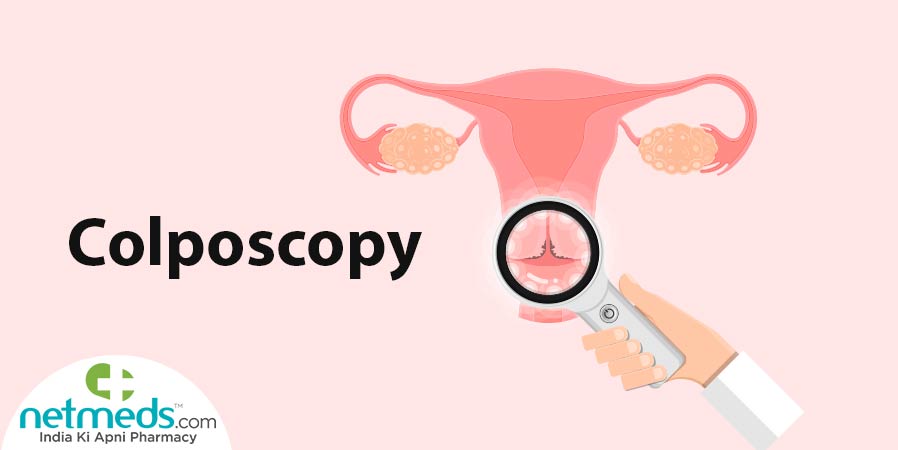 Colposcopy