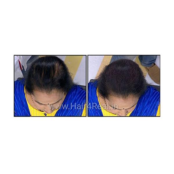 Hair4Real Hair Building Fiber Powder - Dark Brown (Pack of 2 X 25 ml) - Powder