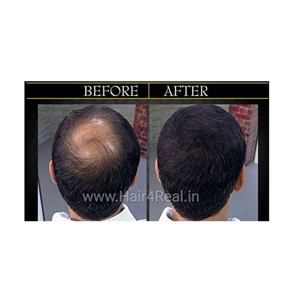 Hair4Real Hair Building Fiber Powder - Dark Brown (Pack of 2 X 25 ml) - Powder