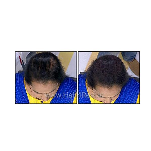 Hair4Real Dark Brown Hair Building Fiber Powder 12 gm + Hair4Real Magic Hair Locking Spray 30 ml - Hair Perms & Texturizers