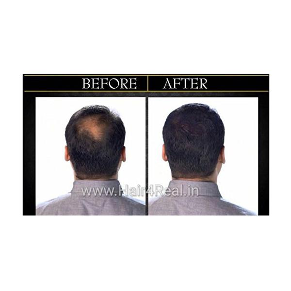 Hair4Real Dark Brown Hair Building Fiber Powder 12 gm + Hair4Real Magic Hair Locking Spray 30 ml - Hair Perms & Texturizers