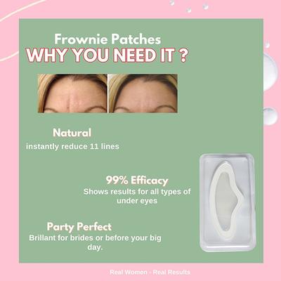 House Of Beauty Frownie Patches 1's - Masks & Peels