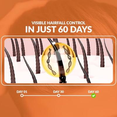 The Herbal Story Hair Fall Control Oil 30 ml - Hair Oils