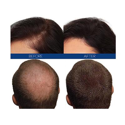 Hair4Real Hair Building Fiber Powder - Black (Refill) 37 gm - Hair Perms & Texturizers