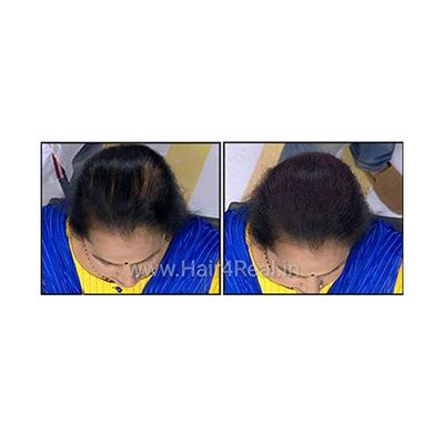 Hair4Real Hair Building Fiber Powder - Black (Refill) 37 gm - Hair Perms & Texturizers