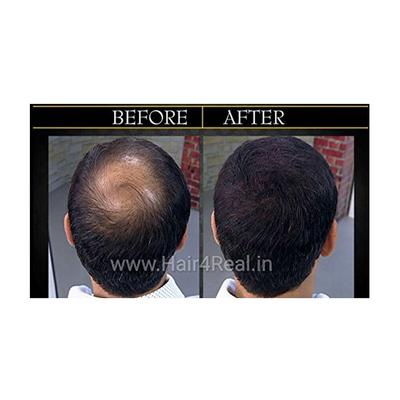 Hair4Real Hair Building Fiber Powder - Black (Refill) 37 gm - Hair Perms & Texturizers