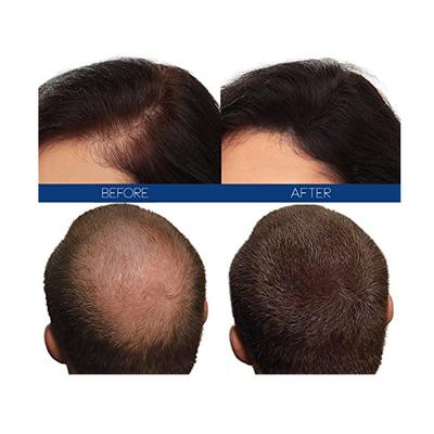 Hair4Real Hair Building Fiber Powder - Dark Brown (Refill) 37 gm - Hair Perms & Texturizers