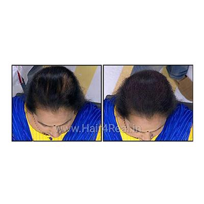 Hair4Real Hair Building Fiber Powder - Dark Brown (Refill) 37 gm - Hair Perms & Texturizers