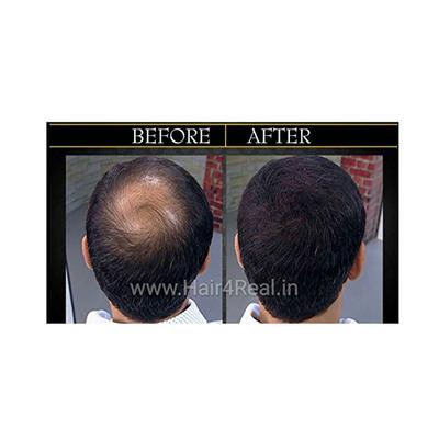 Hair4Real Hair Building Fiber Powder - Dark Brown (Refill) 37 gm - Hair Perms & Texturizers