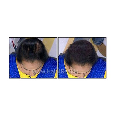 Hair4Real Hair Building Fiber Powder - Black (Pack of 2 X 25 ml) - Hair Perms & Texturizers