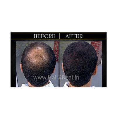 Hair4Real Hair Building Fiber Powder - Black (Pack of 2 X 25 ml) - Hair Perms & Texturizers