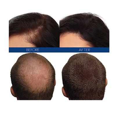 Hair4Real Dark Brown Hair Building Fiber Powder 12 gm + Hair4Real Magic Hair Locking Spray 30 ml - Hair Perms & Texturizers