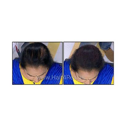 Hair4Real Dark Brown Hair Building Fiber Powder 12 gm + Hair4Real Magic Hair Locking Spray 30 ml - Hair Perms & Texturizers