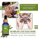Medo Specia Pure Steam Distilled Essential Oil -Tea Tree Oil 15 ml - Essential Oils