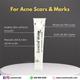SURELITE WHITE Cream 20gm - Hyperpigmentation-Oth