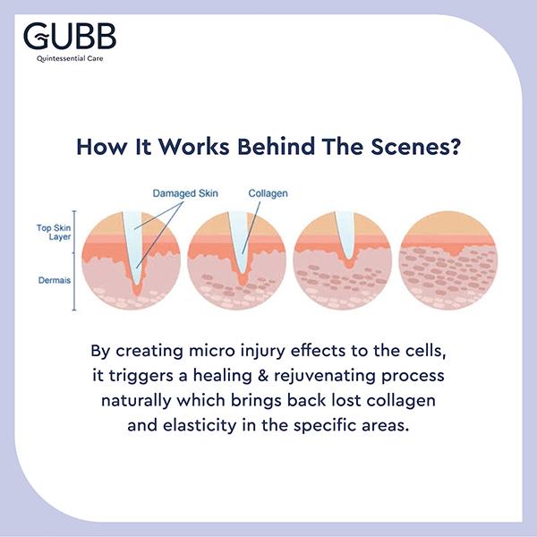 Gubb Derma Roller - Red 540 Needles 0.5mm 1's - Derma Rollers