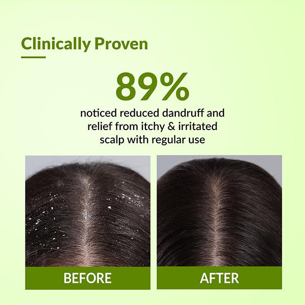 Fixderma Kairfoll Anti Dandruff Shampoo for Oily and Sensitive Scalp, Shampoo for Dandruff 100 ml - Shampoos