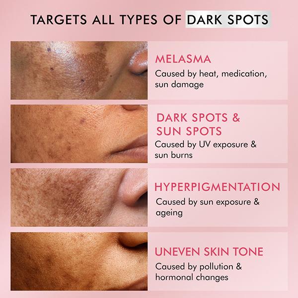 Mcaffeine Clear Glow 3% Tranexamic, 2% Alpha Arbutin Advanced Pigmentation Serum Treatment 20 ml - Face Serum