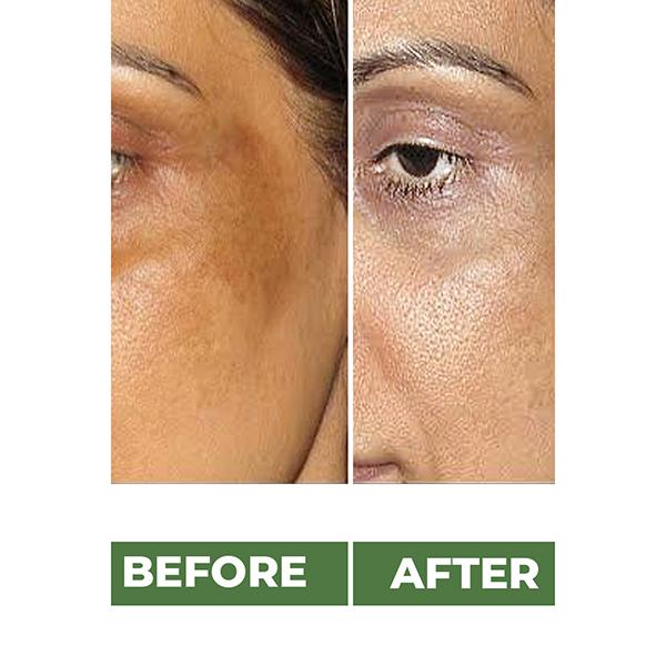 Organic Harvest Skin Lightening Cream 50 gm - Face Creams