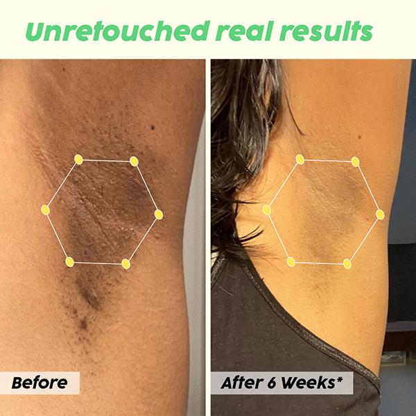 Plix The Plant Fix Pineapple Underarms Lightening Deodorant For Women 100 ml - Women Deodorants/Roll-Ons