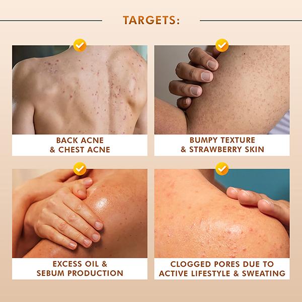 MCaffeine 7% Exfoliating Body Wash- 1% Salicylic 2% Lactic Acid, Shower Gel to Reduce Body Acne 300 ml - Shower Gels & Body Wash