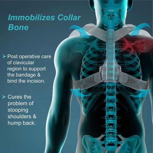 Tynor Clavicle Brace with Velcro (S) (C 05) - Back/Abdomen Supports