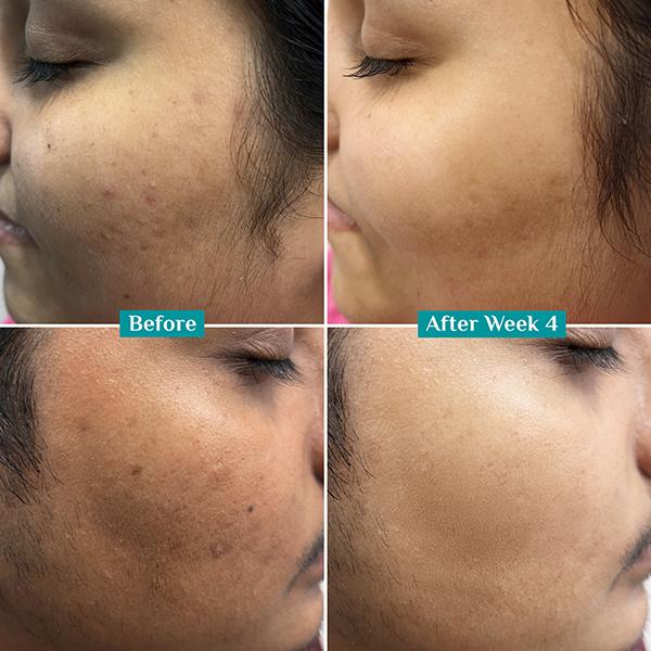 Pilgrim 10% Vitamin C Face Serum For Daily Brightness 10 ml - Face Mists