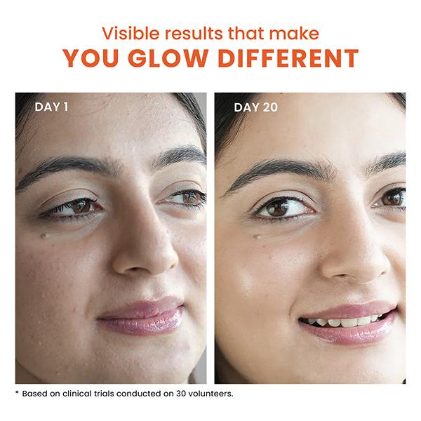 Foxtale The Dazzler Multivitamin Glow Toner + Makeup Setting Spray with Vitamin C + Provitamin B5 150 ml - Face Mists