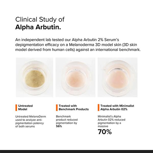 Minimalist Alpha Arbutin Face Serum 30 ml - Face Serum