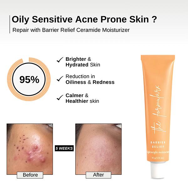 The Formularx Barrier Relief Ceramide Lightweight Moisturizer for Oily, Acne Prone & Sensitive Skin 50 gm - Face Moisturizers