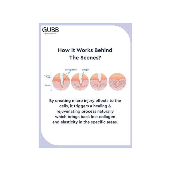 Gubb Derma Roller 0.5 Needle Grey 160 gm - Derma Rollers