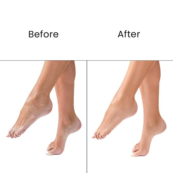 O3+ Pedilogix Scoop Bomb Pedicure with Bath Bomb for Soft & Moisturised Feet -100g+10ml 110 g - Scrubs & Exfoliants