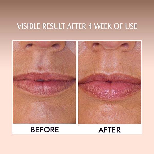Aravi Organic Coffee Lip Lightening Scrub Balm For Dark,Chapped and Pigmented Lips 15 gm - Lip Scrubs