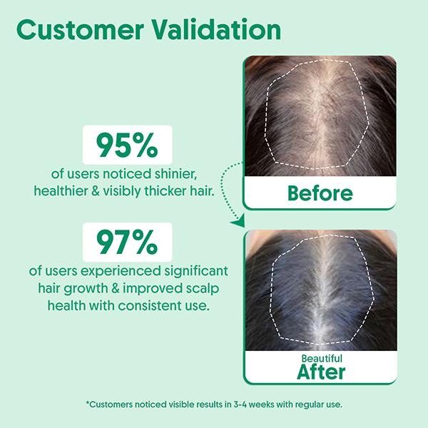 Aravi Organic Rosemary Essential Oil 100% Pure Oil 15 ml - Essential Oils