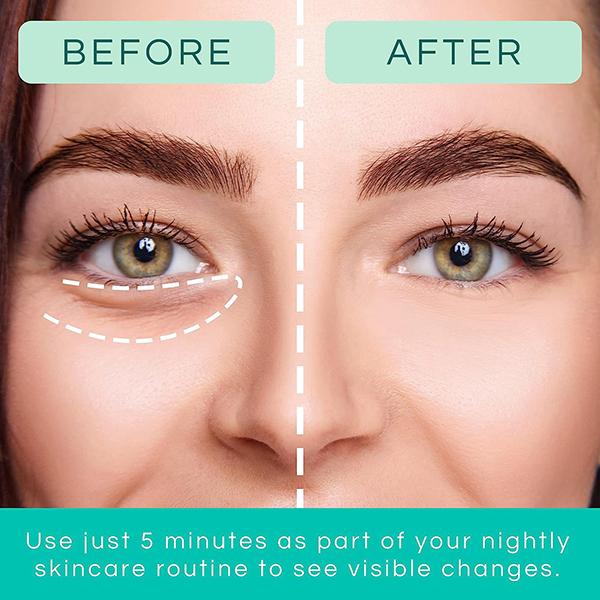 Patchology Flashpatch Restoring Night Eye Gels 5's - Eye Gels & Roll-On